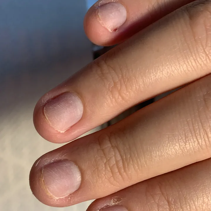 Avant : ongles naturels courts, sans pose